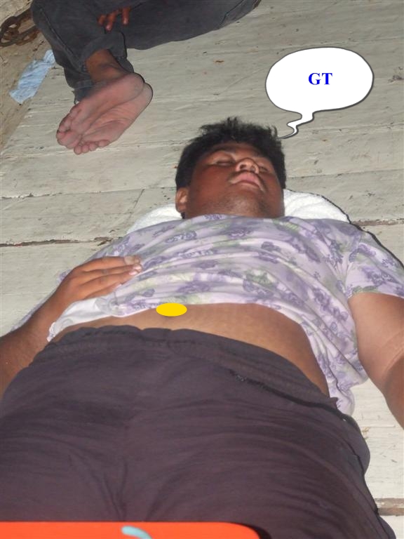  [q]เป็นเรื่องธรรมชาติแบบโหนคันเหงื่