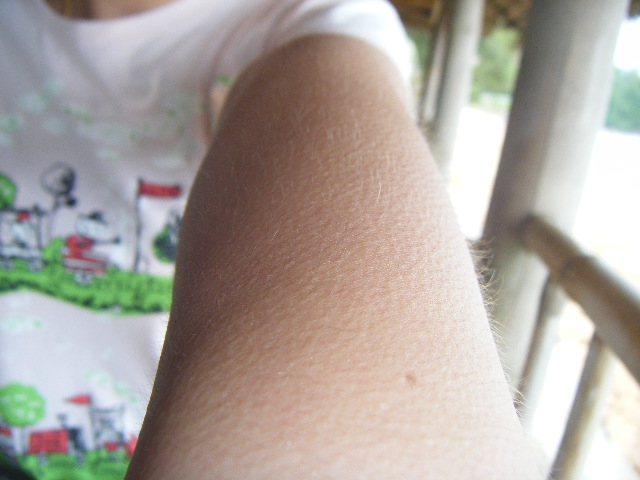 [b][center]แต่วันนี้ลมแรงมากๆแถมเย็นอีกตั้งหาก ดูซิครับขนลุกกันเห็นๆ :ohh: :ohh: :ohh: :ohh: