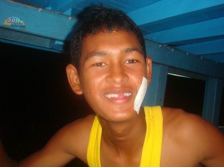 เดือดร้อนคนจิ๊กไม่ได้  เจ้าอ๊ากมันกัดใหญ่เลย....กัดจนฟันหักไปซี่นึงแระ.... :laughing: :laughing: :la