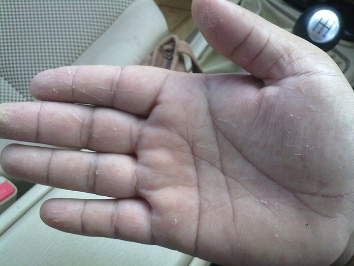 พอล้างมือเสร็จมาดูมือตัวเอง    โอวววววว  แม่เจ้า