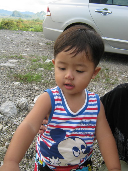 กลับมาบ้านรุ่งเช้า แว๊ก ลูกพ่อไปโดนอะไรมาเนี่ย จมูกเป็นแผลเลย  ก็ปรากฏว่าช่วงที่ผมไปตกปลา เจ้าตัวเล็