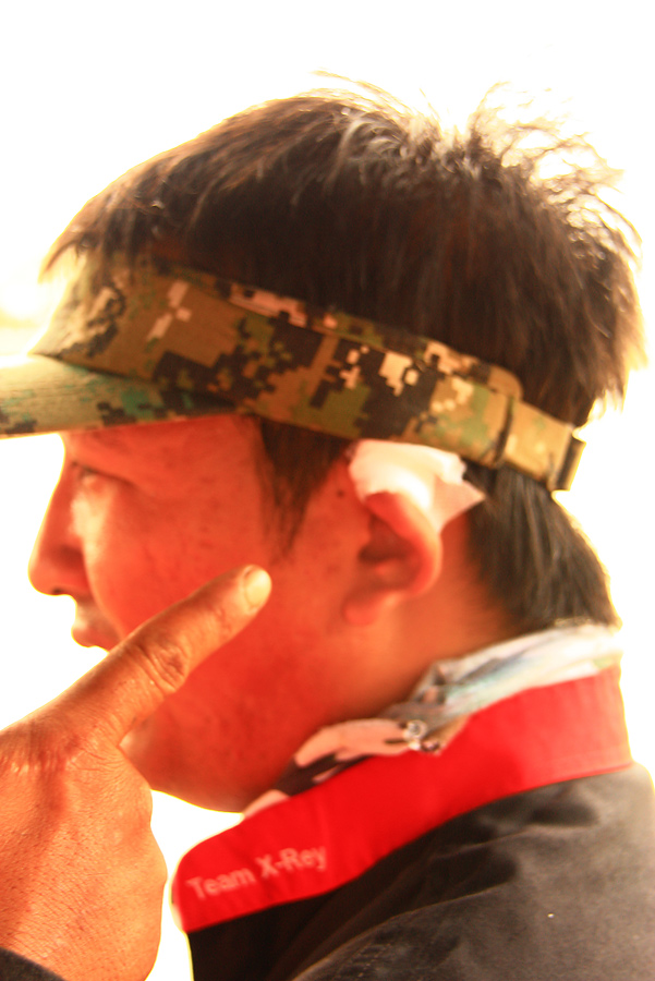 น้าแยม เอ๊กซ์เรย์...ปายโดนอารายมาคร้าบบบบบบ  :grin: :grin: :grin: