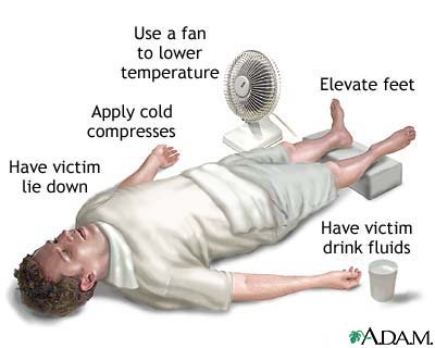 Heatstroke=โรคลมแดด