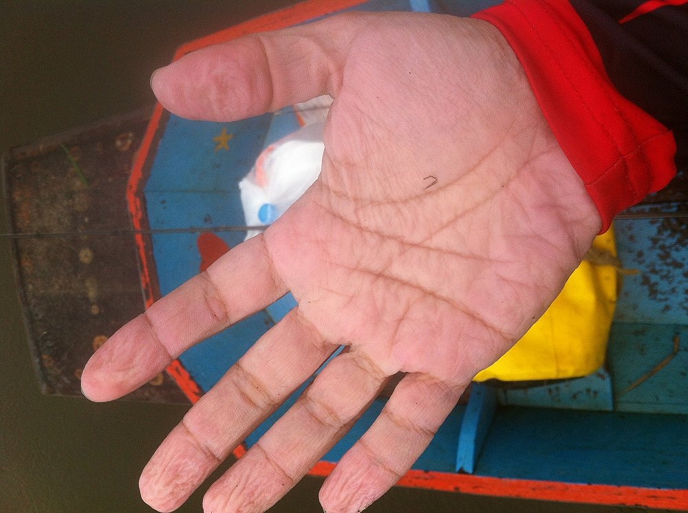 มือแช่น้ำทั้งวัน เปื่อยเลย :sad: :sad:
