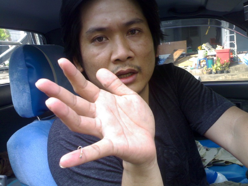 เจ็บตัวเพราะหวังดี...ซะงั้น..
